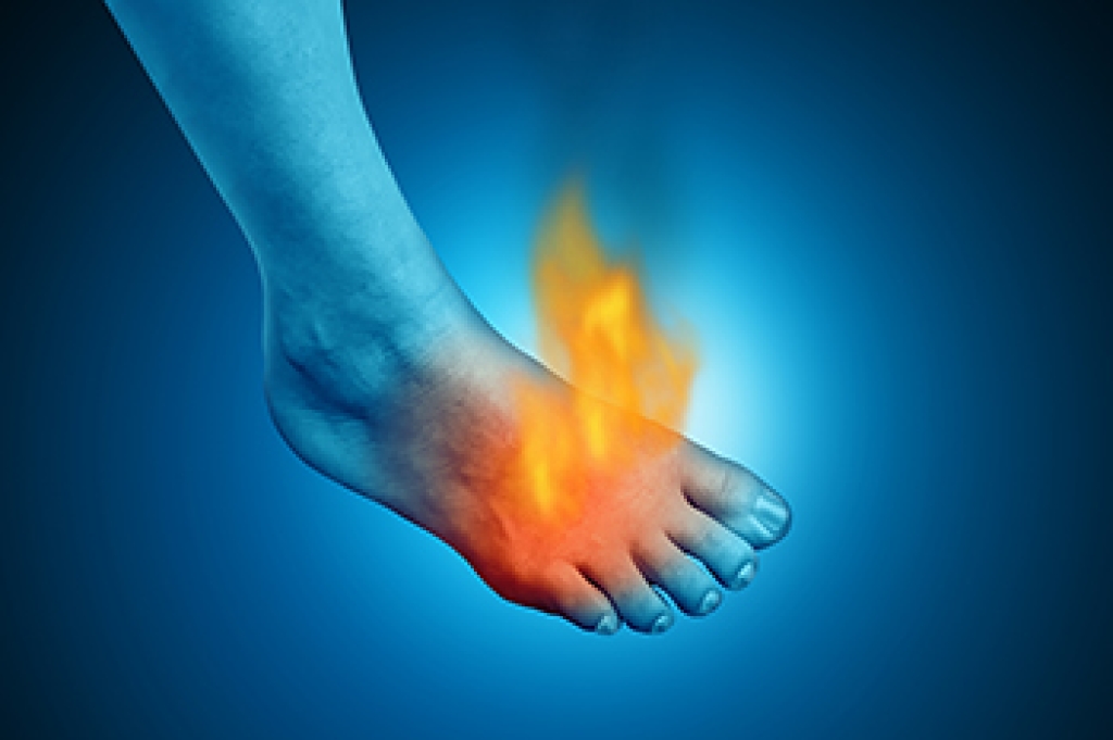Burning Foot Pain Could Signal Nerve Damage