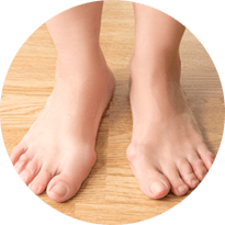bunion