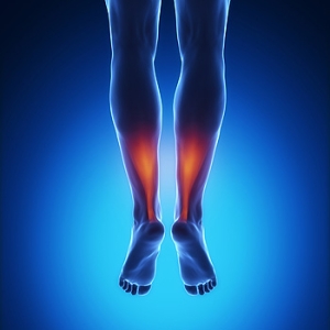 Possible Treatments for an Achilles Tendon Injury