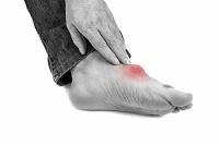 What Are The Causes Of Gout?