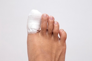 What Is Turf Toe?