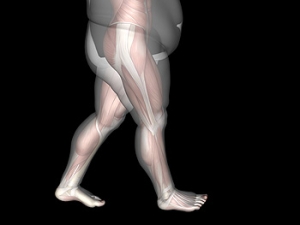 Excess Weight May Cause Flat Feet in Children