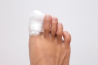 What You Need to Know About Broken Toes
