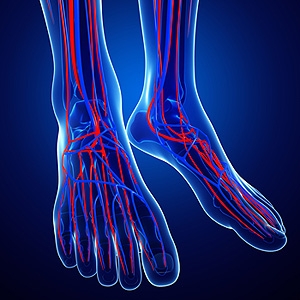 Treating Poor Circulation