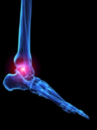 Immune Disorder May Cause Rheumatoid Arthritis